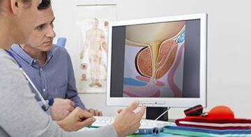 diagnozuoti vyrų prostatitą